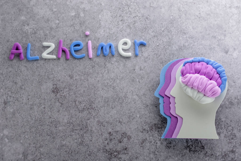 Alzheimer’s word beside a layered head and brain model