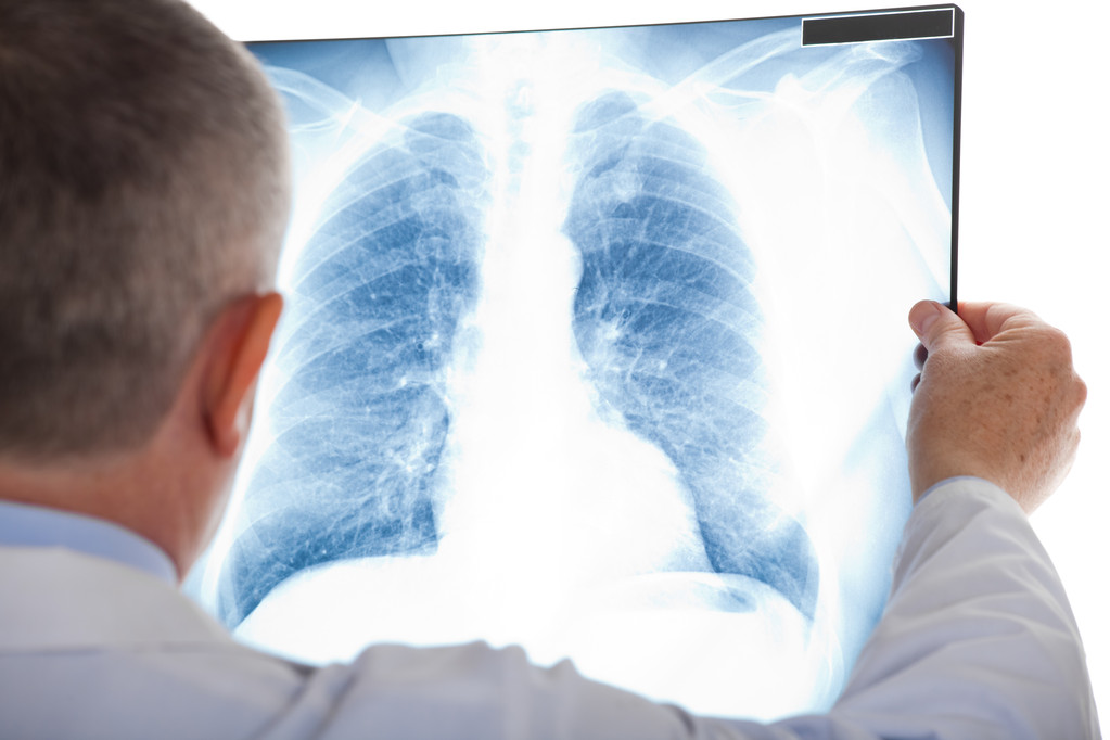 Person in a lab coat examining a chest X-ray film.